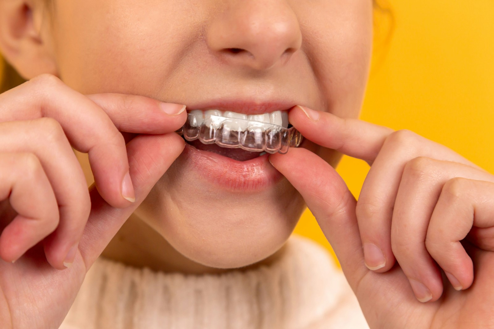 Tratamiento de estética dental